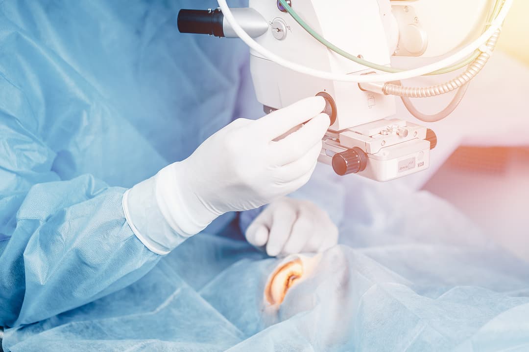 Lasik treatment. Laser vision correction. Doctor examines fundus in microscope, patient under sterile cover
