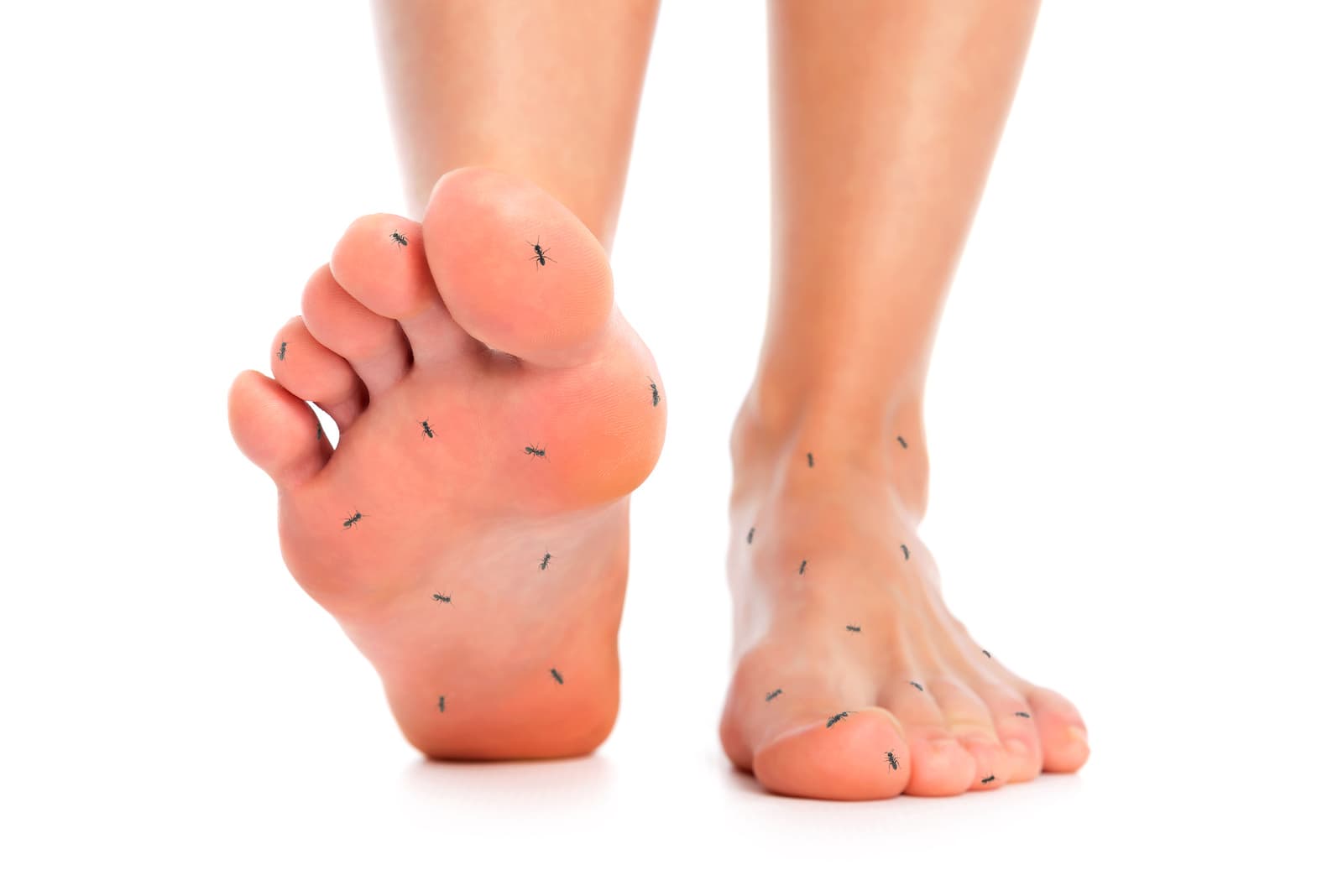 feet with ants demonstrate diabetic neuropathy