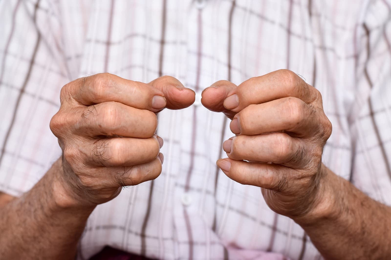 Man with painful arthritis hands