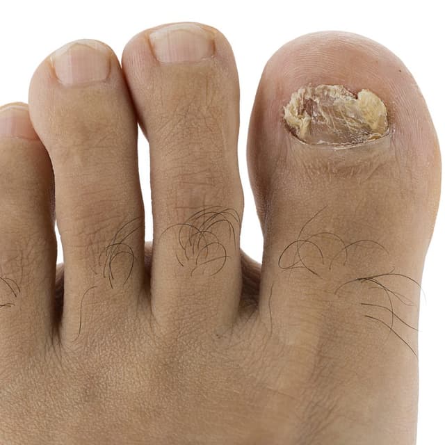 Does Peeing On Your Feet In The Shower Help Kill Bacteria BEST GAMES