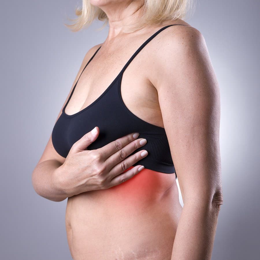Woman holding her hand to her left breast, suffering from under breast rash and under-breast itching
