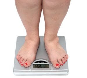 Obese obesity overweight weight loss
