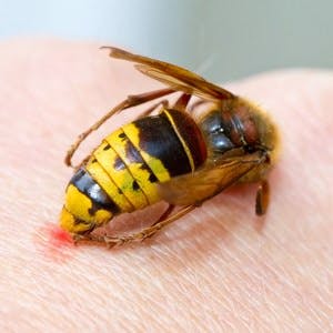 Hornet sting on human hand  of man
