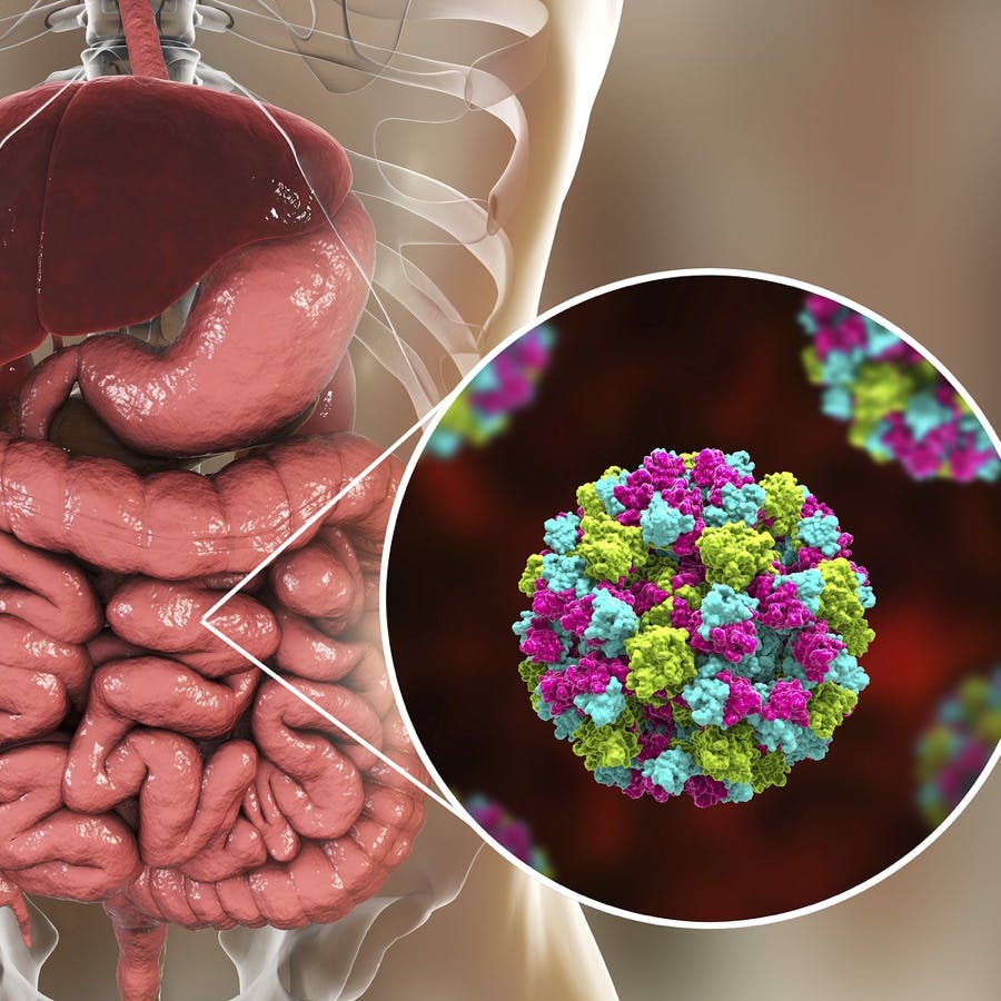 Norovirus in human intestine, also called winter vomiting bug, RNA virus from Caliciviridae family, causative agent of gastroenteritis with diarrhea, vomiting, stomach pain. 3D illustration
