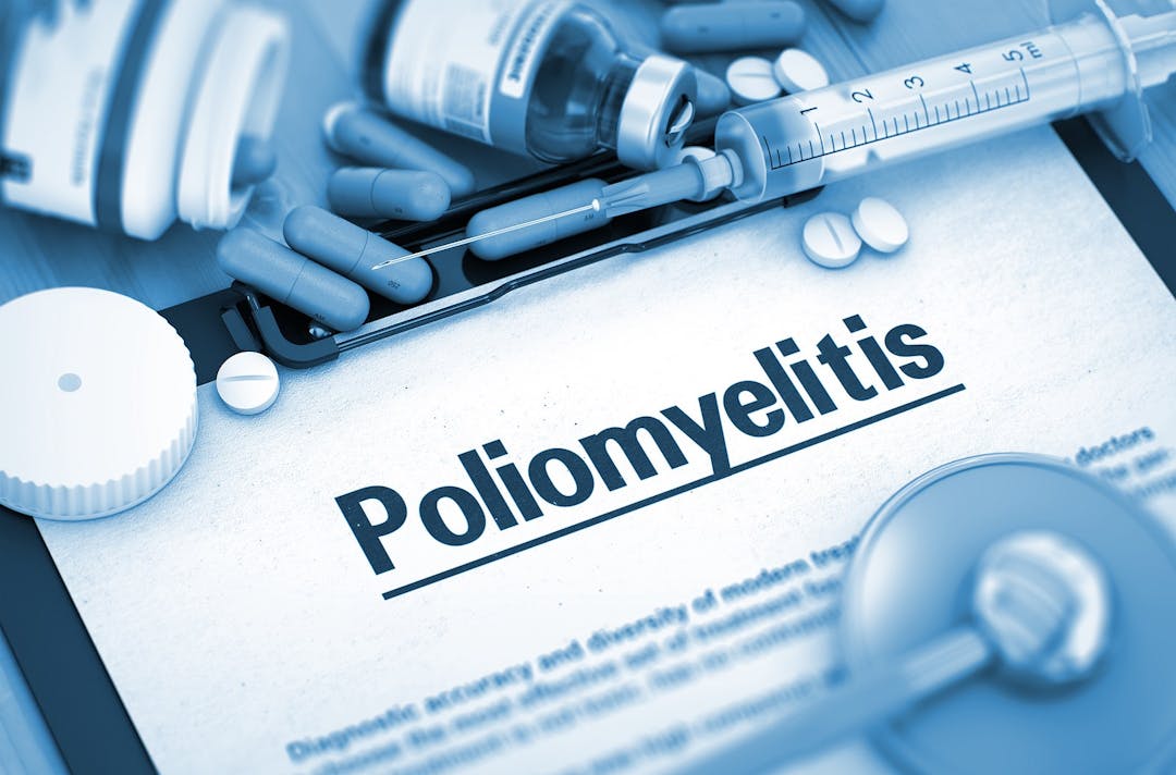 Poliomyelitis, Medical Concept with Selective Focus. Poliomyelitis &#8211; Printed Diagnosis with Blurred Text. Poliomyelitis, Medical Concept with Pills, Injections and Syringe. 3D Toned Image.
