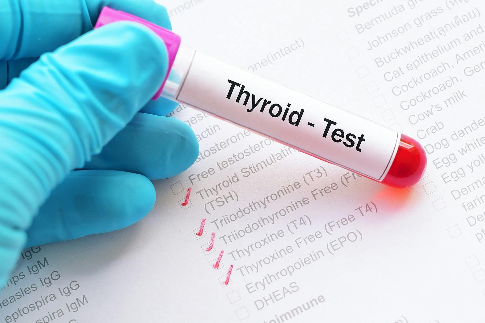 Thyroid test tube. Will levothyroxine alone normalize thyroid function?
