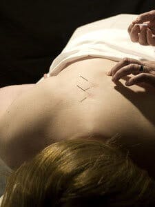 Acupuncture, acupuncture helps women accupuncture
