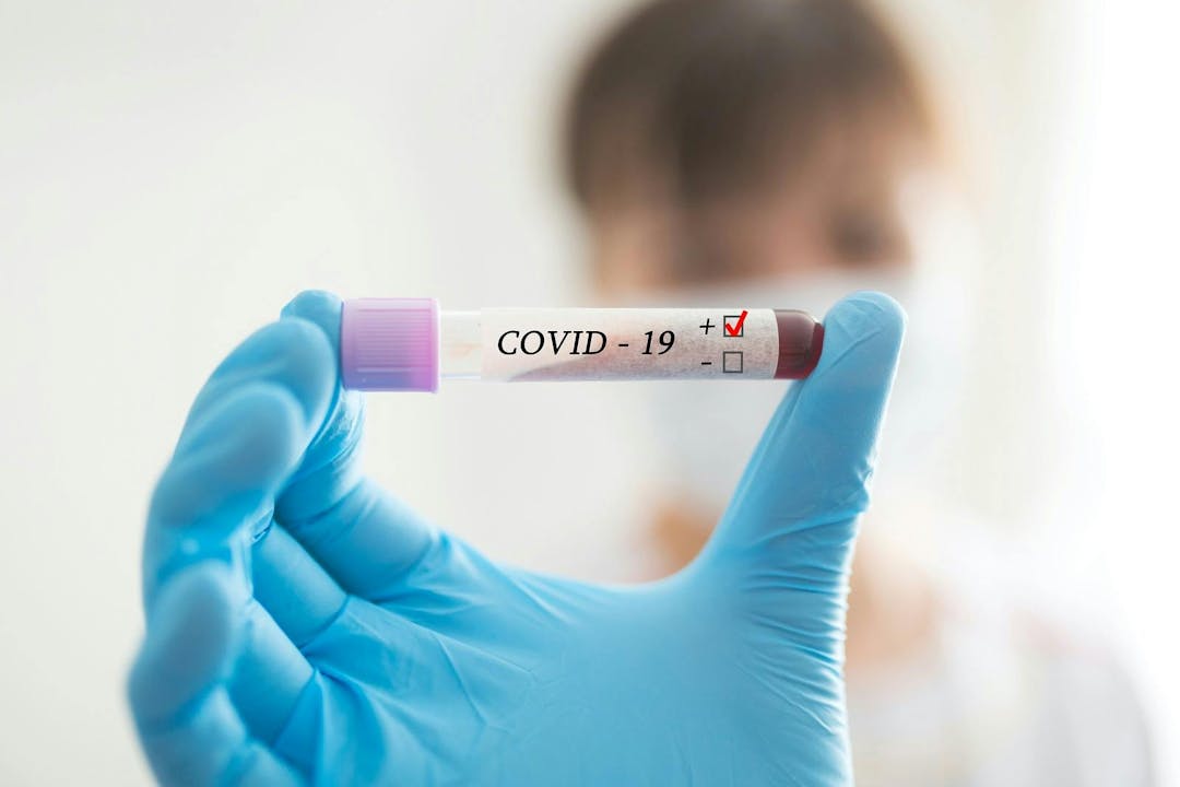 Novel Coronavirus blood test Concept. Nurse holding test tube with blood for 2019-nCoV analyzing.
