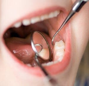 Teeth dentist kid cavity
