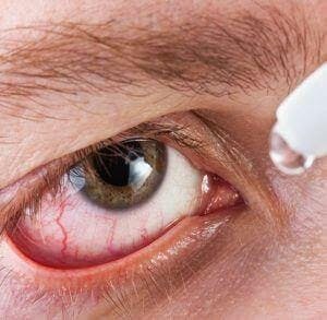 Medicine healthcare liquid eyedropper on human eye
