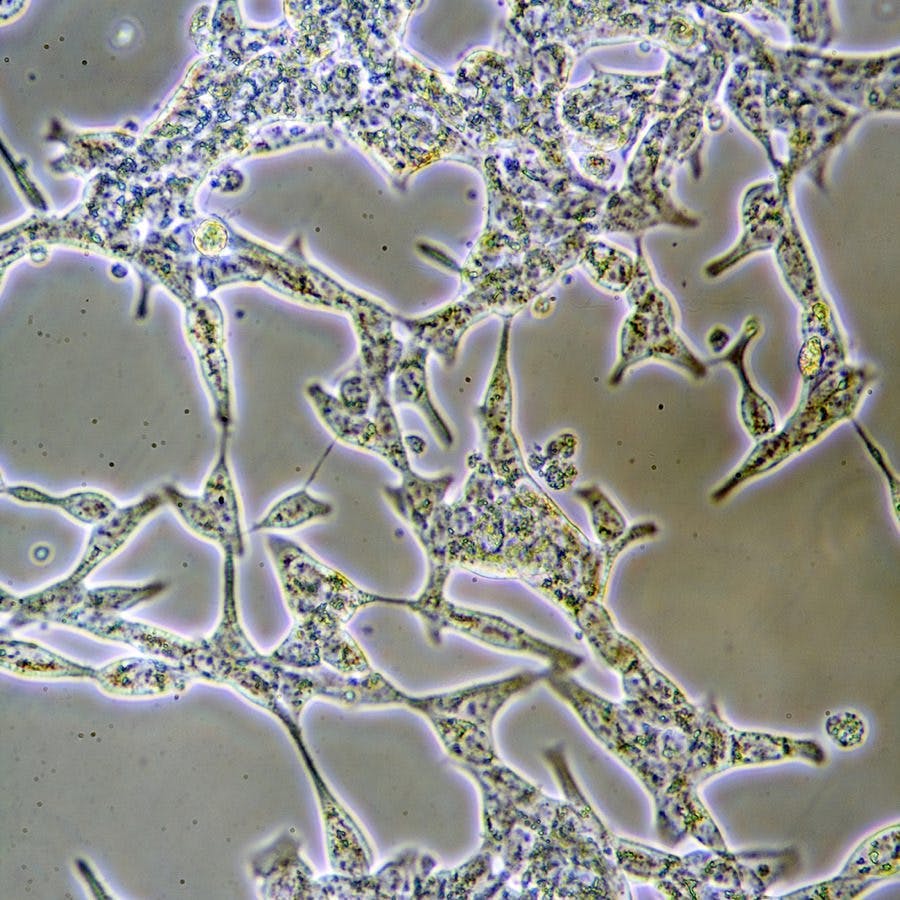 Microscope view of mens health Prostate Cancer cells in tissue culture showing walls nucleus and organelles.
** Note: Slight blurriness, best at smaller sizes
