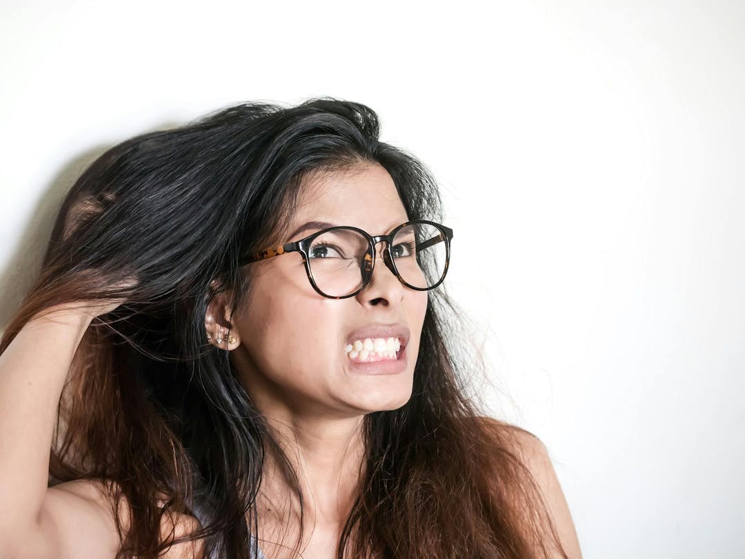 Women have itchy scalp fungus, Healthy concept

