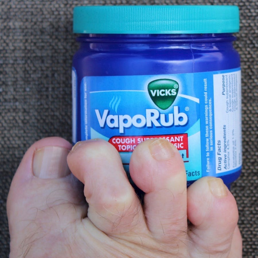 Vicks VapoRub and toenails
