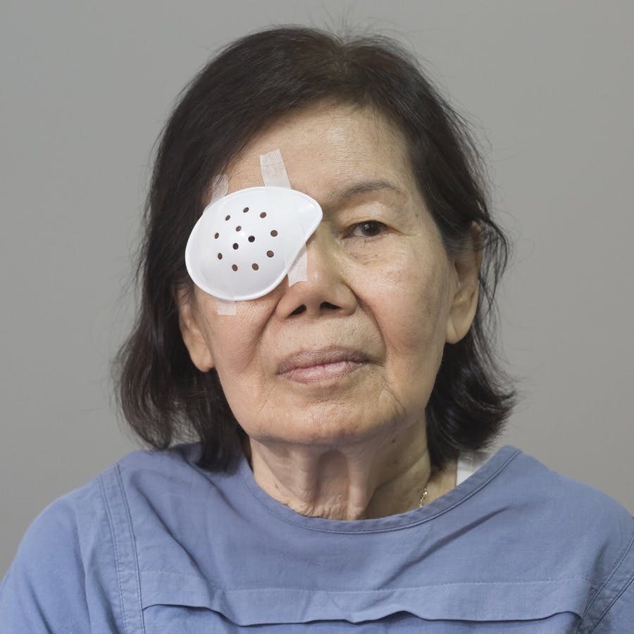 Eye shield covering after cataract surgery .
