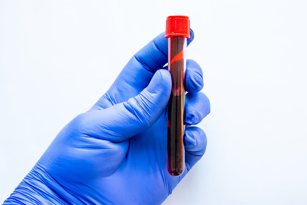 Scientist, laboratory worker or doctor holds tube with blood on white background in his gloved hand. Taking blood from vein for laboratory medical tests, scientific experiments, clinical testing
